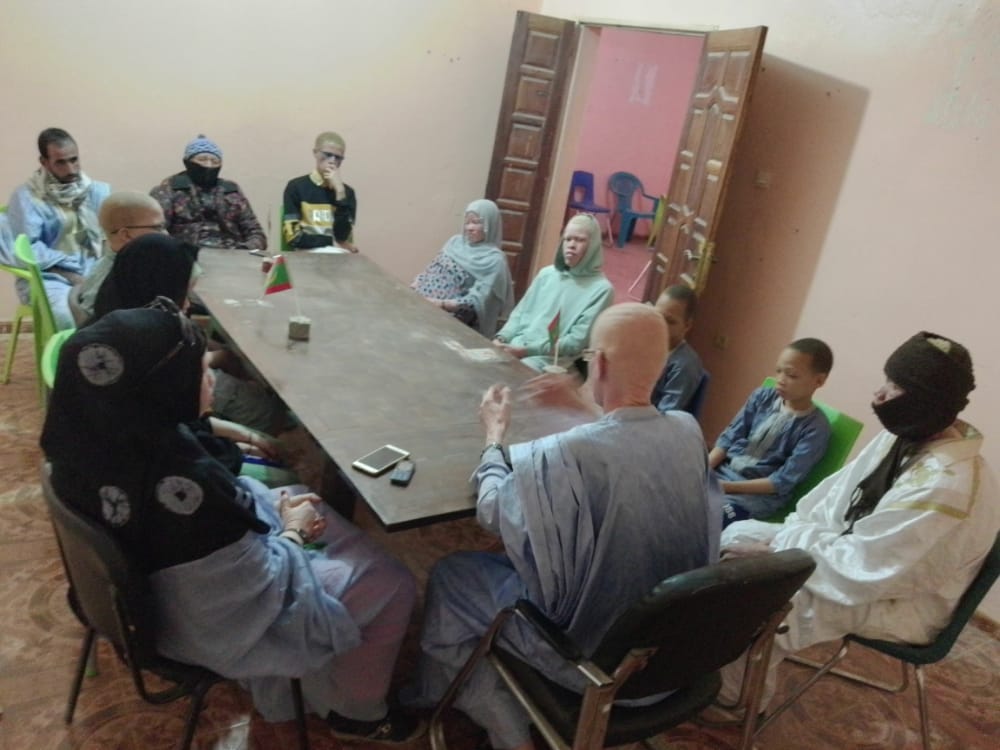 منظمة دعم المهق: قطاع العمل الاجتماعي لم يستجب لمشاكل هذه الشريحة 