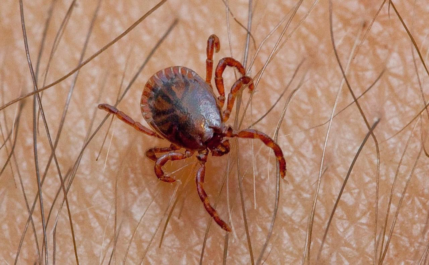 كيف تتجنب الإصابة بفيروس حمى القرم النزفية ؟